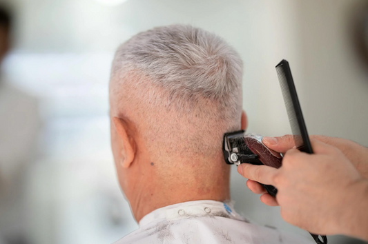 Navigating Through Hair Loss: Causes, Solutions, and Prevention